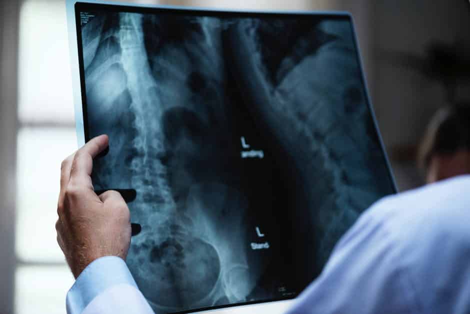 New York Will Extend Time to File Medical Malpractice Claims in Cancer Cases
