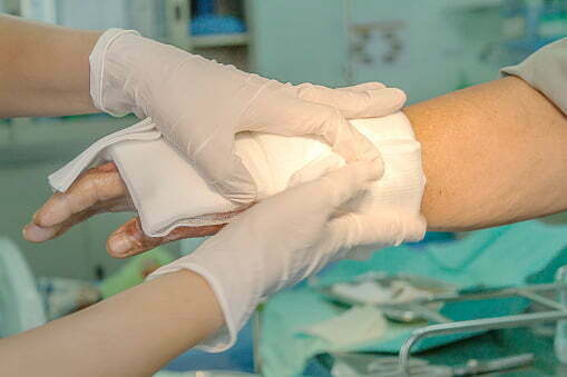 doctor putting bandage on burn victim's hand after handling defective packaging of a product.